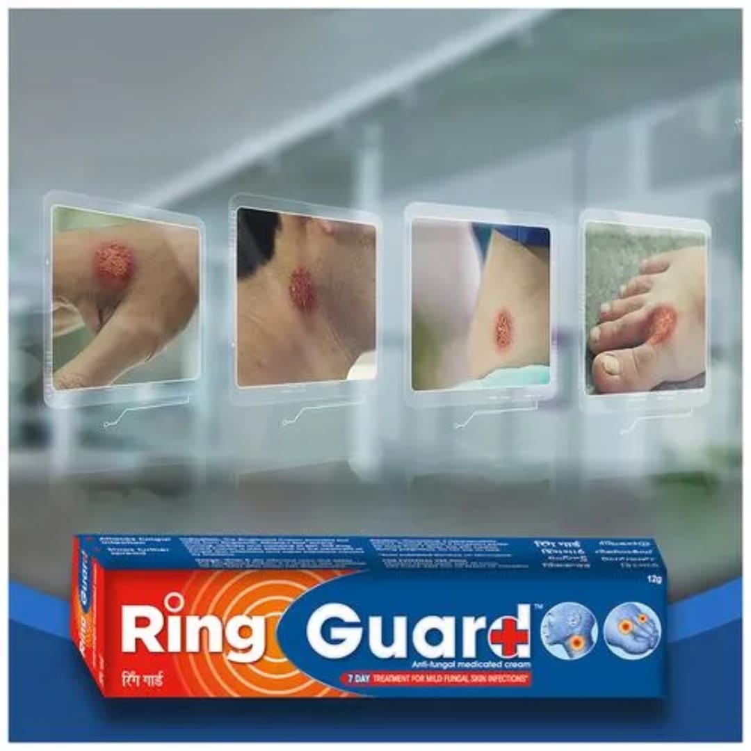 Ring Guard Anti-Fungal Cream, 12 g