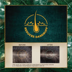 Indulekha Dandruff Treatment Shampoo, 200 Ml