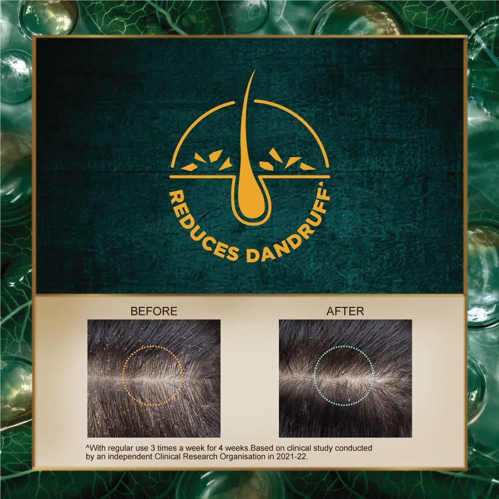 Indulekha Dandruff Treatment Shampoo, 200 Ml